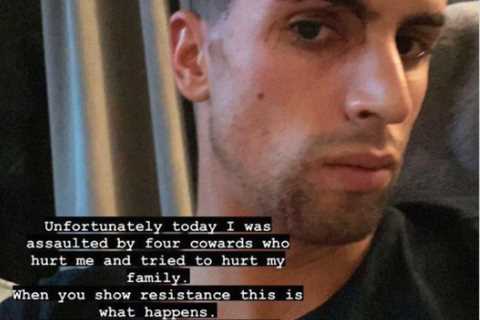 Joao Cancelo reveals horror facial injuries after being attacked by four thugs ‘who hurt me and..