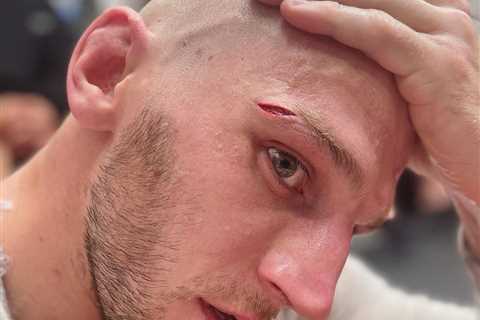 MMA star Dan Hooker shows off graphic horror eye cut as he targets UFC Perth in February