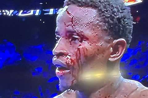 Boxing match STOPPED after fighter suffers horror head injury as he is left with blood pouring down ..