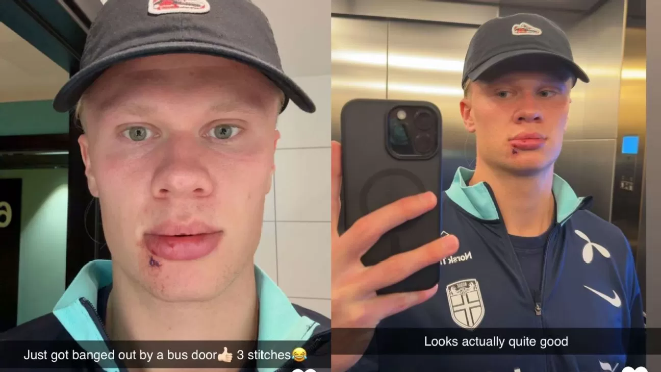 Haaland Injury Update – Cleared for Norway Match